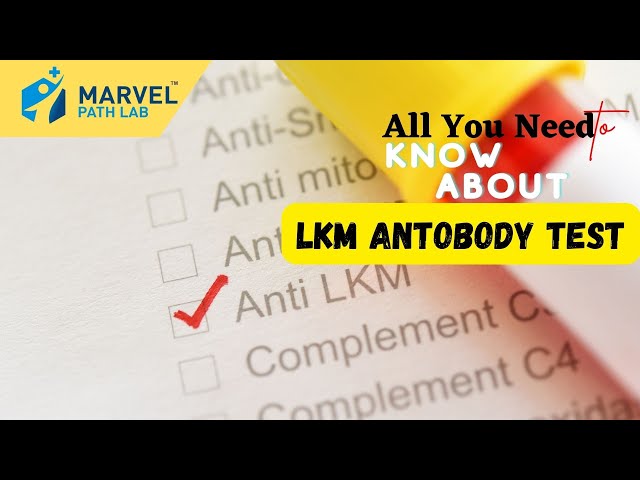 Ultimate Guide to LKM Antibody Test Everything You Need to Know