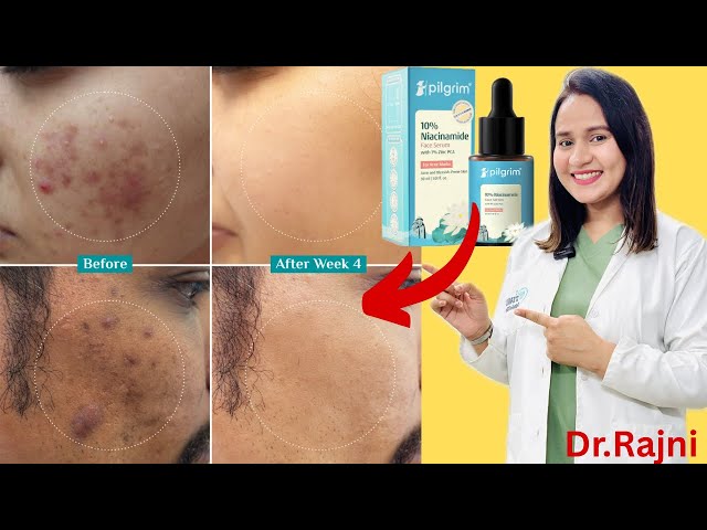 Pilgrim 10% Niacinamide Serum Kaise Use Karen | Pilgrim 10% Niacinamide Serum Review In Hindi |