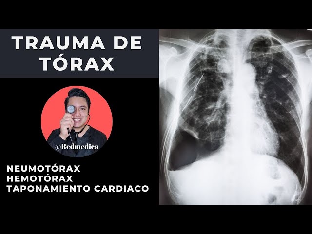 ATLS | Chest Trauma | #ENARM2021 | 🩺Dr. Treviño