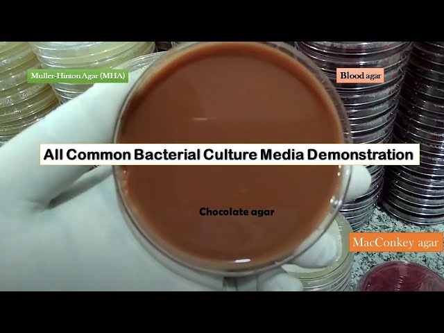 All common Bacterial Culture Media Demonstration/ Blood agar/ Macconkey/ Chocolate agar/ MHA