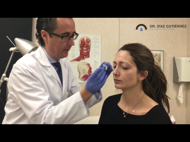 Botox application step by step - Dr. Díaz Gutiérrez, plastic surgeon in Madrid
