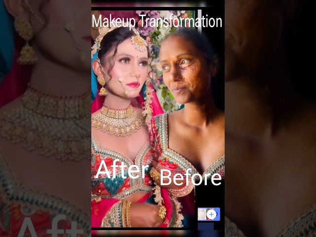 Unbelievable Transformation! 😱 Chehre ke daag gayab ho gaye ✨ #shorts #viral #makeuphacks​