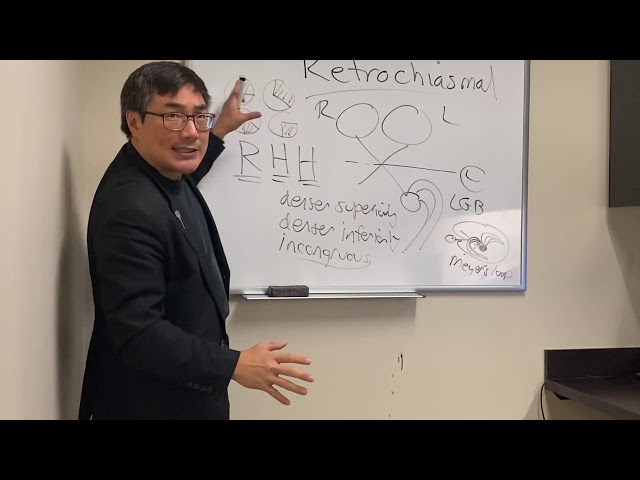Retrochiasmal pathway