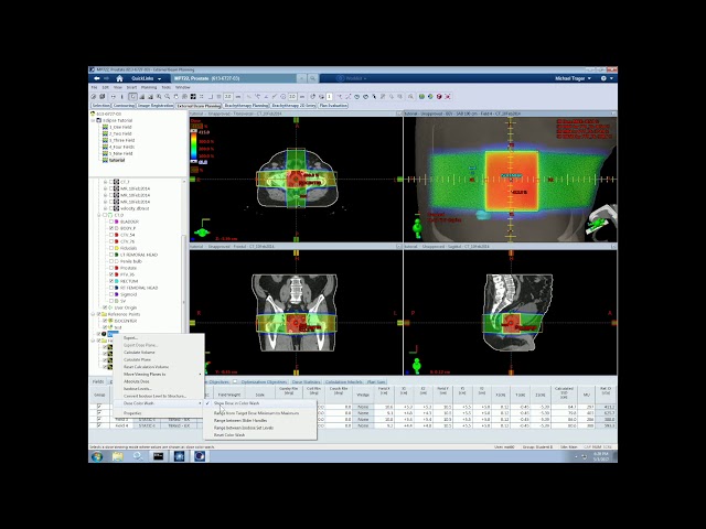 Tutorial 4   Basic 3D Planning in Eclipse
