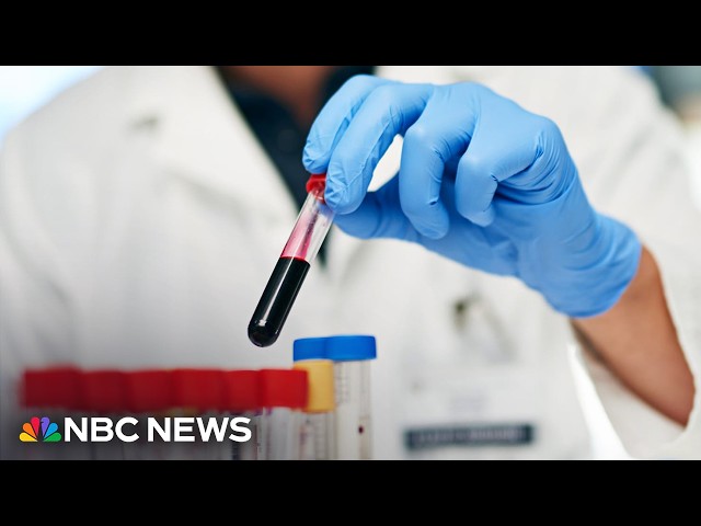 New guidelines for managing cholesterol