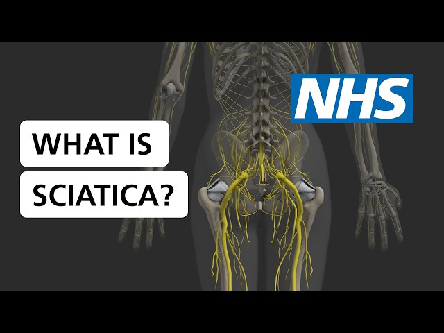 What is sciatica? | NHS