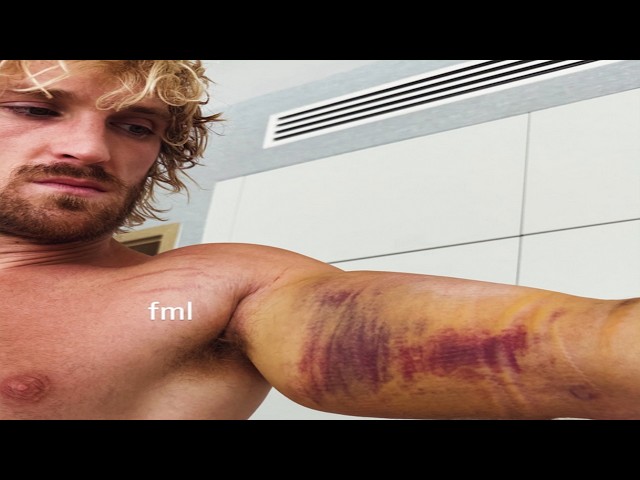 Logan Paul Is In Huge Trouble