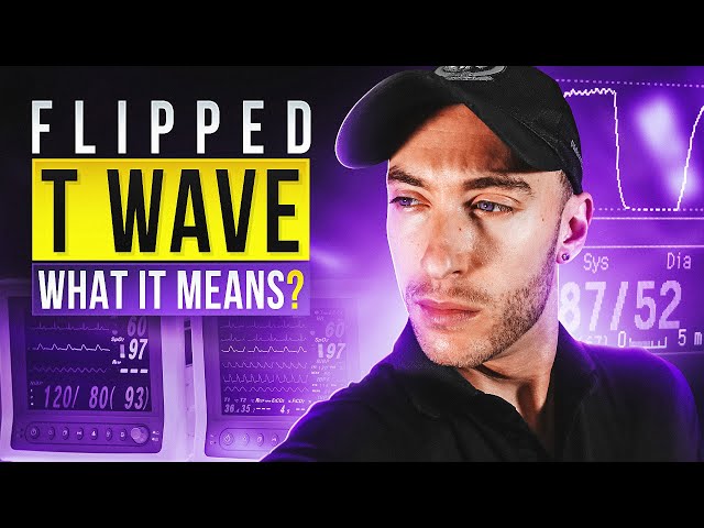 12 Lead EKG Review for Paramedic School | What is an Inverted T Wave Mean?