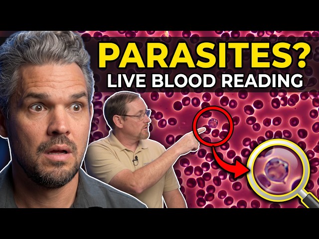 Live Blood Analysis: Checking My Blood for Parasites