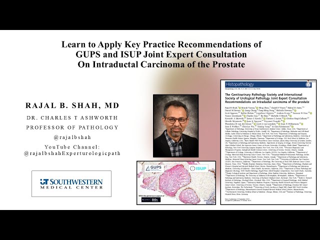 Learn How to Apply GUPS and ISUP Intraductal Carcinoma of the Prostate Practice Recommendations