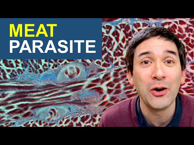 Why I would not eat this meat |  Parasite Worms in meat under the microscope