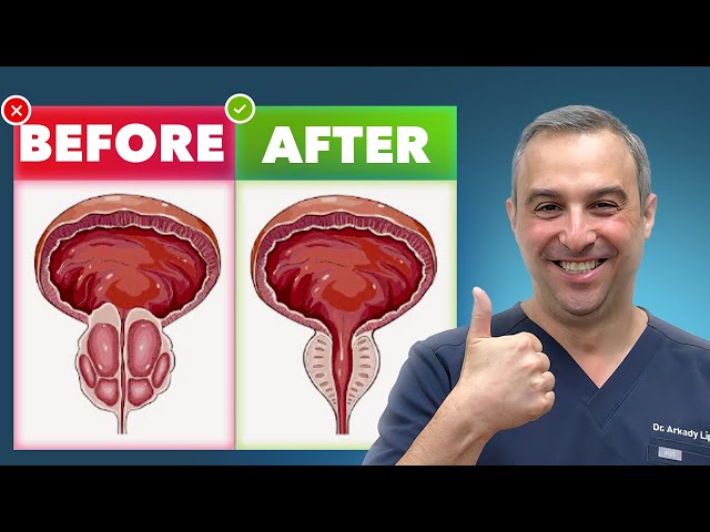 Shrink Enlarged Prostate Naturally Without Pills