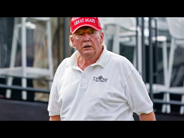 Trump looks VERY different and doctors are worried
