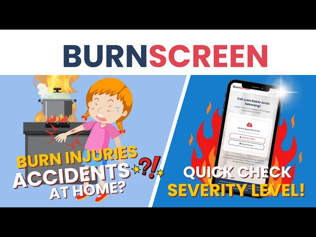 AI Burn Injury Detection Website Using TensorFlow.js | BurnScreen [2026]