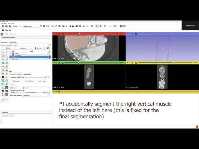 0   3D Slicer Tutorial   FULL RECORDING