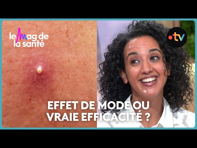 Are pimple patches actually effective against acne?