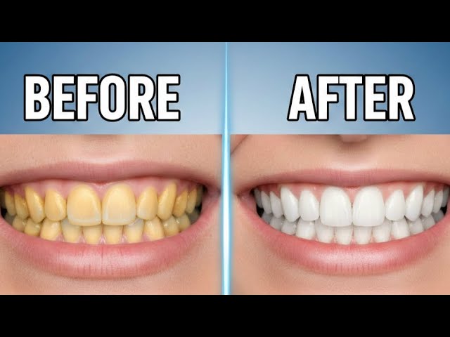 Yellow to white teeth | easy solution 😁