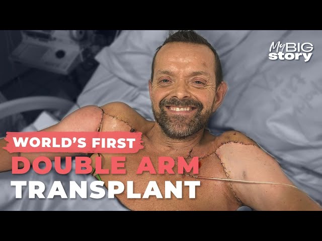 World's First Double Arm Transplant: 'It's Science Fiction'
