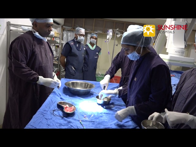 PDA (patent ductus arteriosus) device closure surgery by Dr. Vijay Kumar Reddy at Sunshine Hospitals