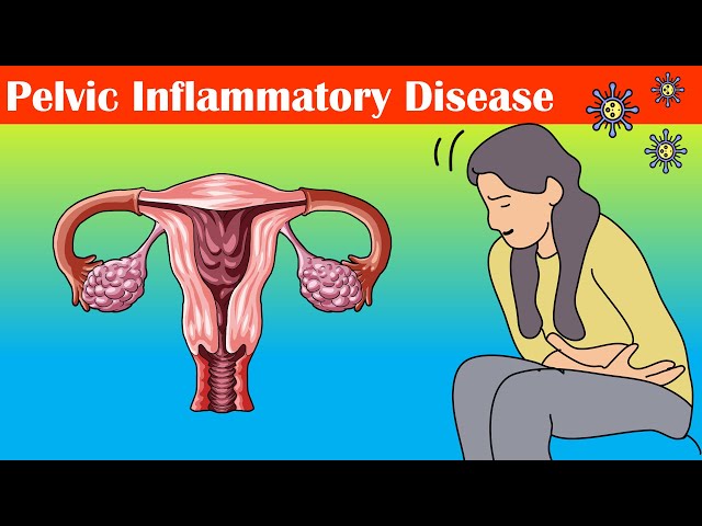 Pelvic Inflammatory Disease (PID) - Causes, Signs & Symptoms, Diagnosis, And Treatment