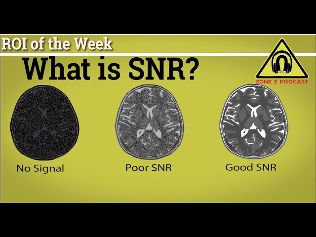 What is SNR? And Why is it so Important? One of MRI most important Metric "SNR" Explained