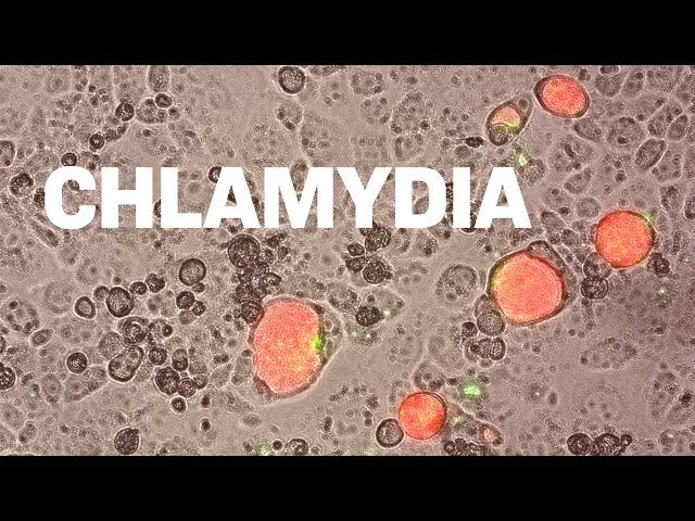 Fluorescing Parasites | Researching Chlamydia