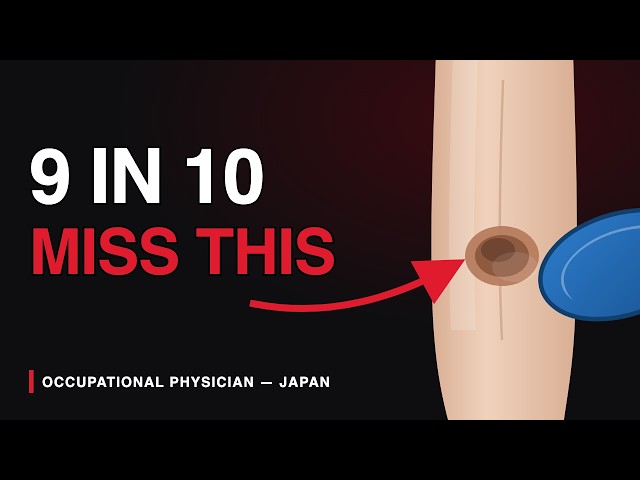 Japanese Doctor: 7 Kidney Warning Signs Most People Miss