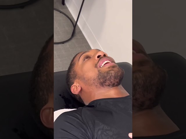 Anthony Joshua, boxing champion, gets the Ring Dinger® treatment from Dr. Ali Elahi DC #ringdinger