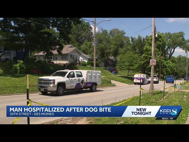 Des Moines man hospitalized after dog attack