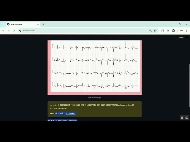 Cardiac Arrhythmia Classification in Python Projects