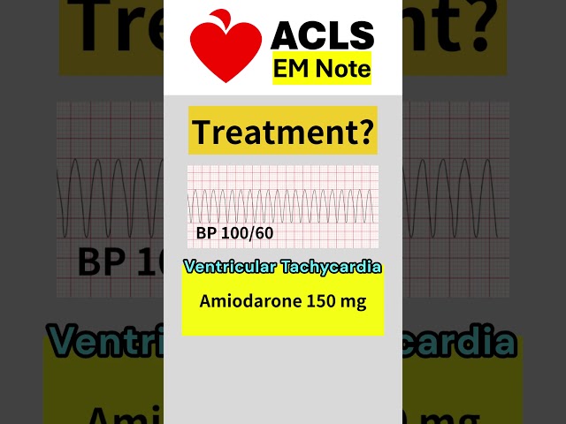ACLS Rhyrhm Test #acls