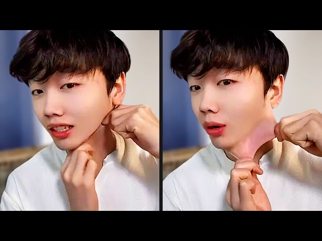 He Has Really Stretchy Skin