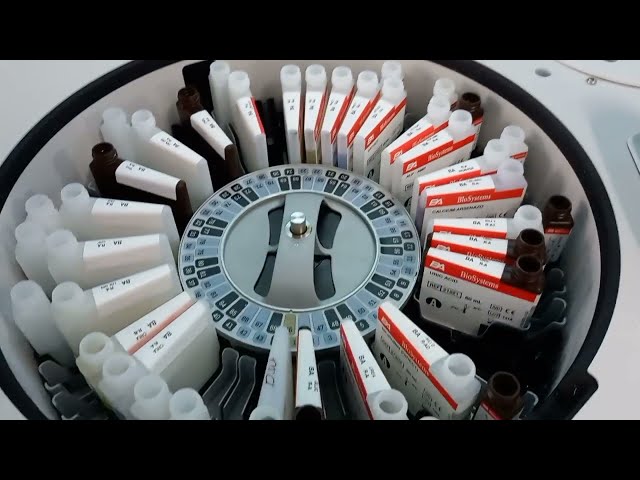 How to Run Biochemistry Test in Fully Automatic Analyzer