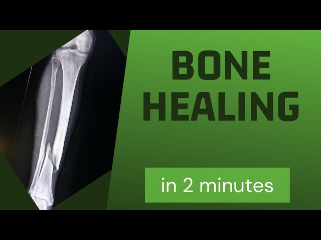 Bone healing in 2 mins!