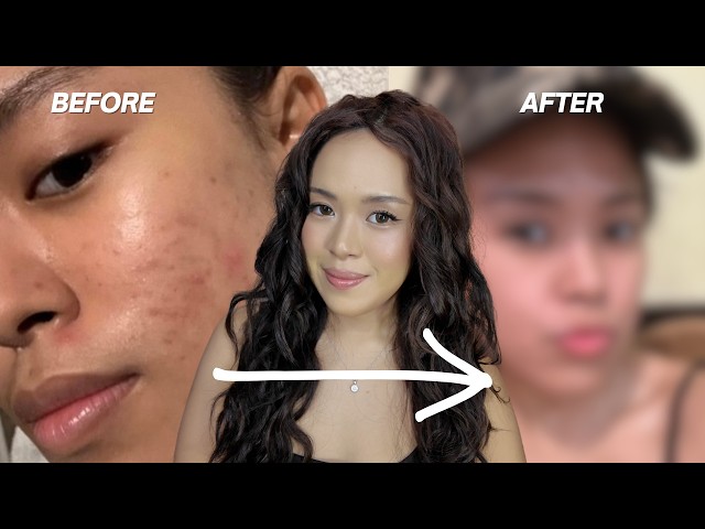 you look unrecognizable!!! | How I did it with LOA