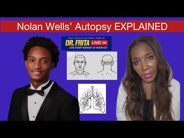 Nolan Wells' Autopsy EXPLAINED