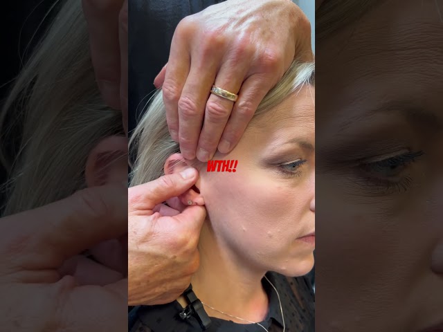 Epic Ear Adjustment! #chiropractic #asmr #chiropractor #adjustment #trending
