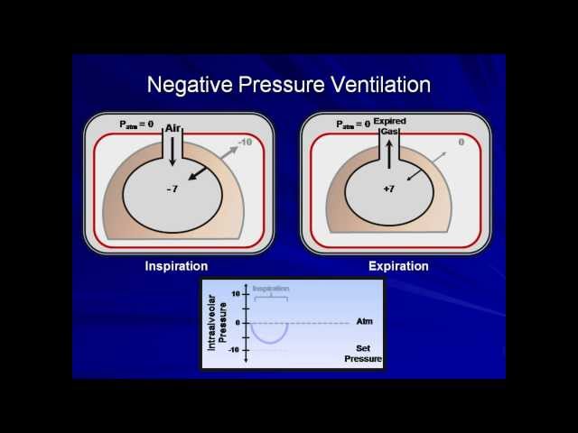 An Introduction to Mechanical Ventilation (Mechanical Ventilation - Lecture 1)