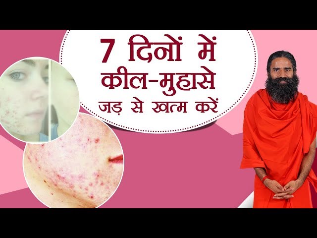 7 दिनों में कील मुँहासे (Pimples, Acne) जड़ से खत्म करें | Swami Ramdev
