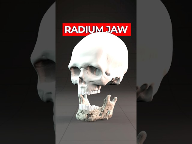 The True Story of the Radium Girls