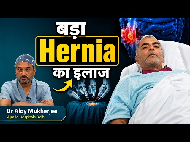 बड़ा Hernia और Rectus Muscle Separation का इलाज | 56 साल की उम्र में बड़ा Hernia! Dr aloy mukherjee