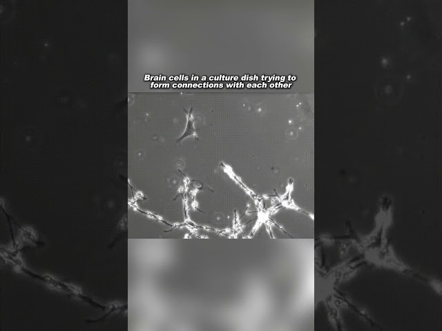 Brain Cells Forming Connections