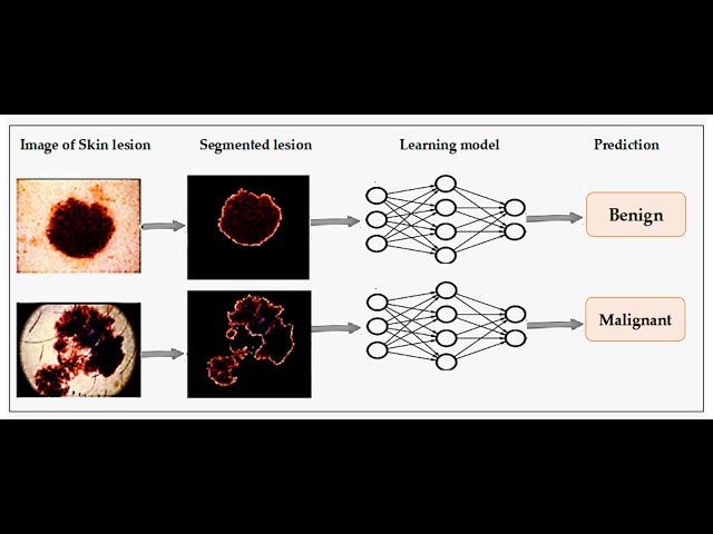 Skin Disease Detection Using Neural Network Python OpenCV Project Source Code