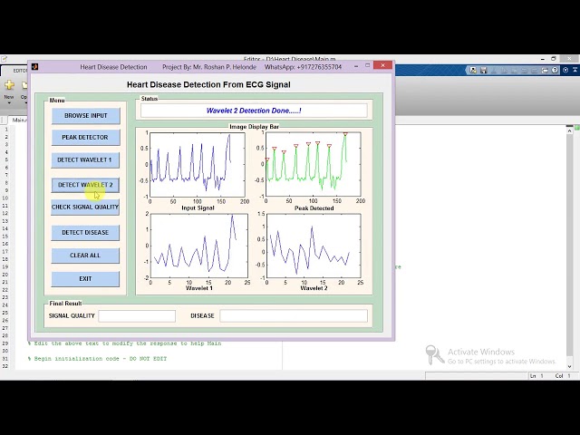 Matlab Code for Heart Disease Detection from ECG Signal
