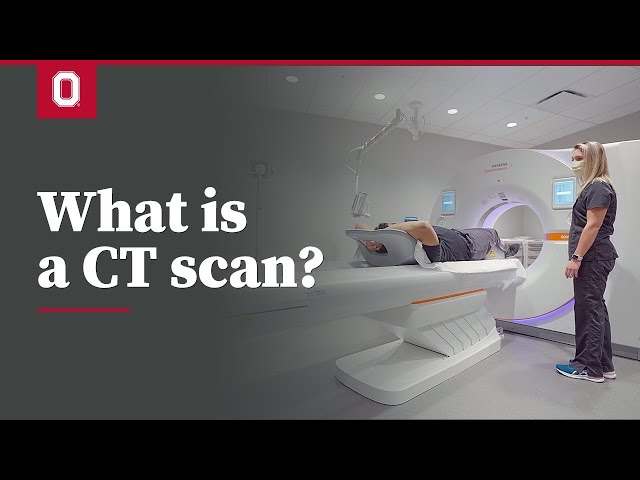 What is a CT scan? | Ohio State Medical Center