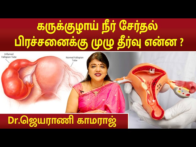 கருக்குழாய் நீர் சேர்தல் பிரச்சனைக்கு முழு தீர்வு என்ன ? | Dr.Jeyarani Kamaraj |