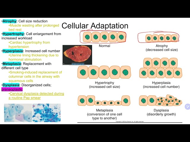 Pathophysiology Week 1 Quiz Review