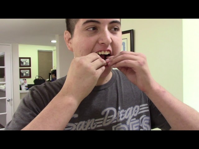 New treatment, Tourettes Tics cease, Dr. Demerjian TMJCONNECTION.COM