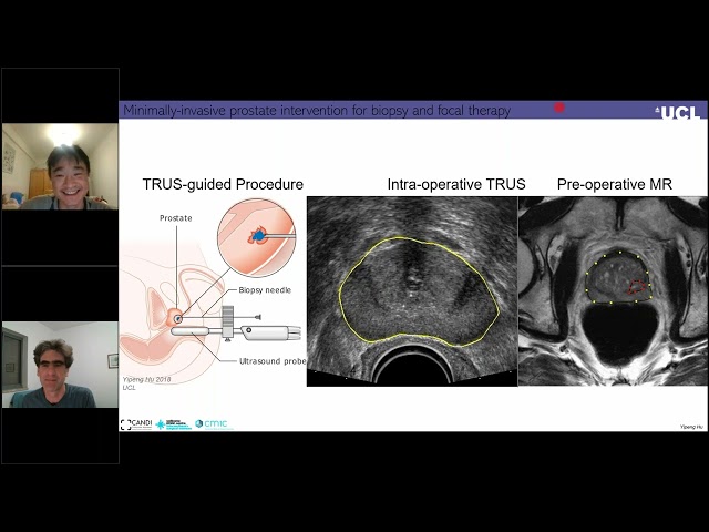 Machine Learning in Ultrasound Guided Surgery and Intervention - Webinar by RSIP Vision / Yipeng Hu