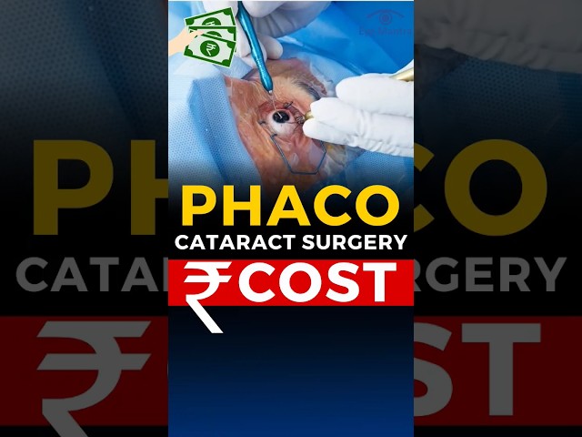 Phaco Cataract Surgery Cost